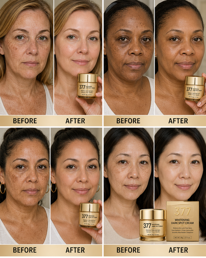 💥 Last Day Deal: Buy1 Bottle, Get 1FREE! FLUMYR 377 BrighteningSPF Face Cream - DarkSpot, Hydration & Anti-Wrinkle Care
