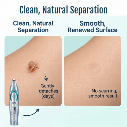 🔥LIMITED-TIME 50% OFF! Flumyr® SpotlessPro Advanced Skin Care Pen